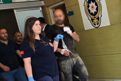 Bursa'da iş kazası: Parmağından oldu