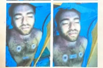 Cem Garipoğlu’nun otopsi görüntülerinde flaş iddia