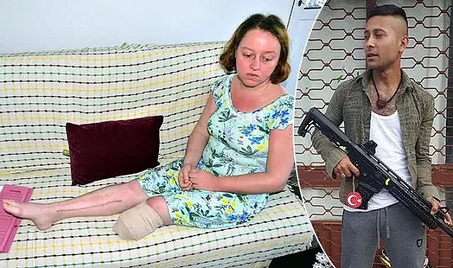 Eşinin bacağının kesilmesine neden olan eşe indirimsiz ceza