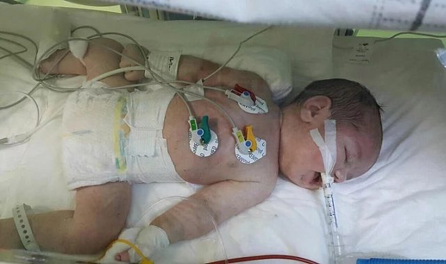 Hastanede skandal olay! Doğum sırasında bebeği geri rahime ittiler