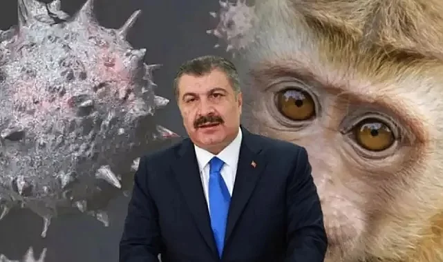 Türkiye'de Maymun Çiçeği virüsü görüldü
